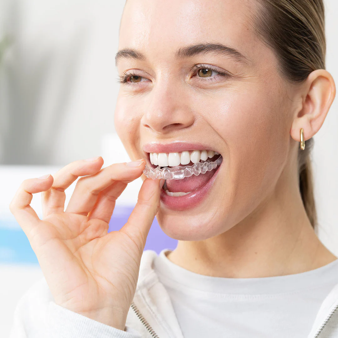Clear aligners