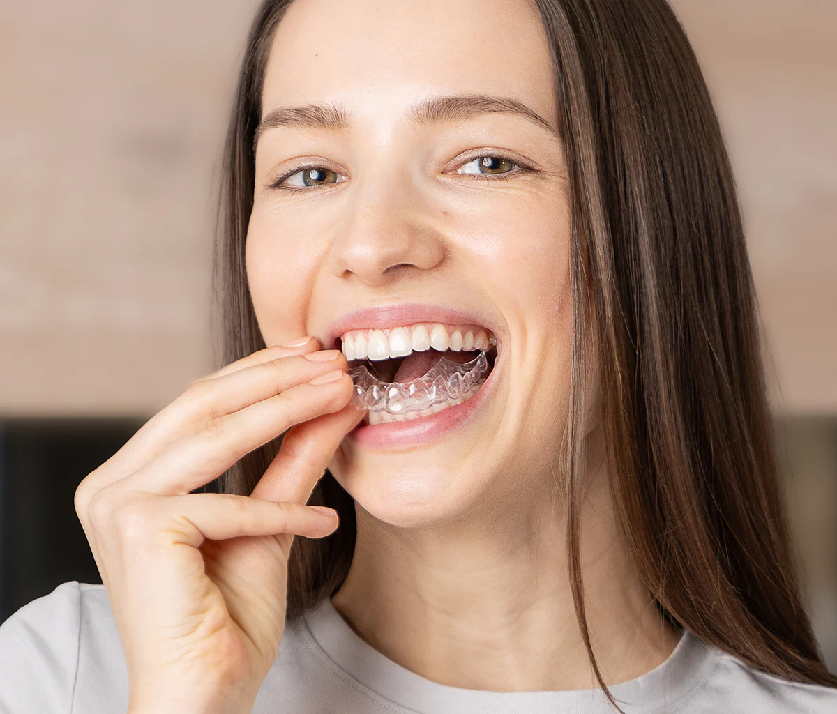 Teeth whitening kit - Image 8